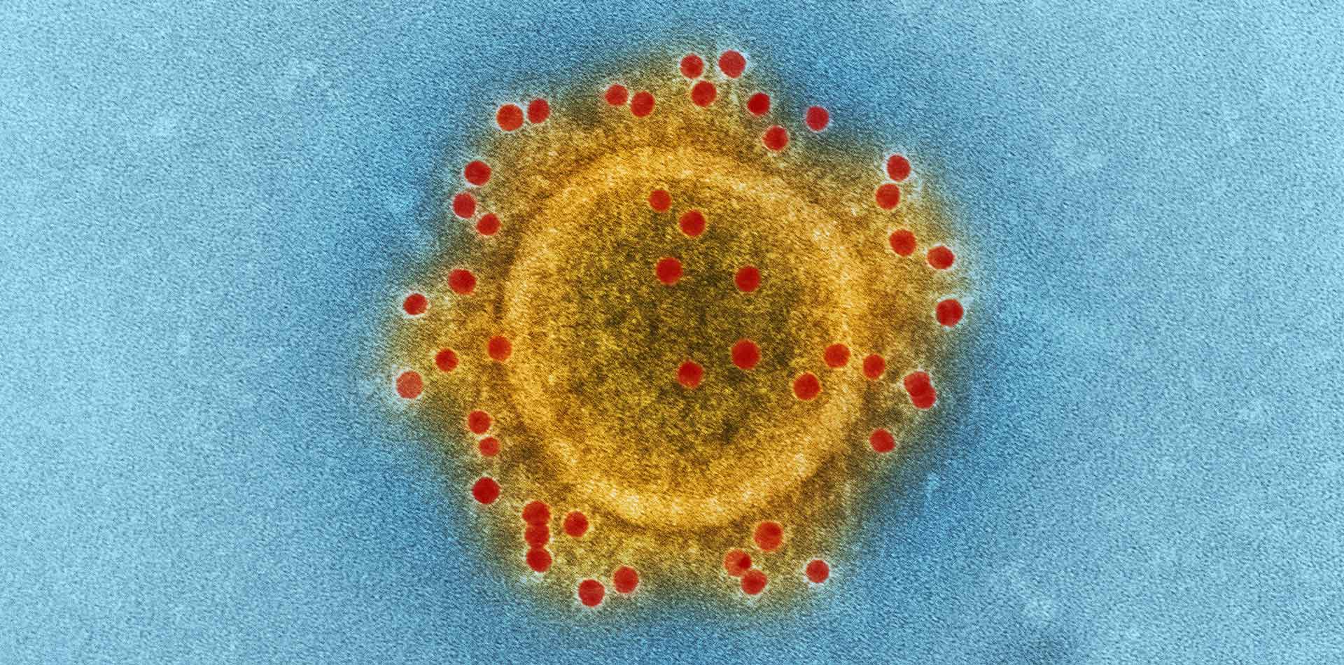 Why You Must Experience Caronavairus At Least Once In Your Lifetime.